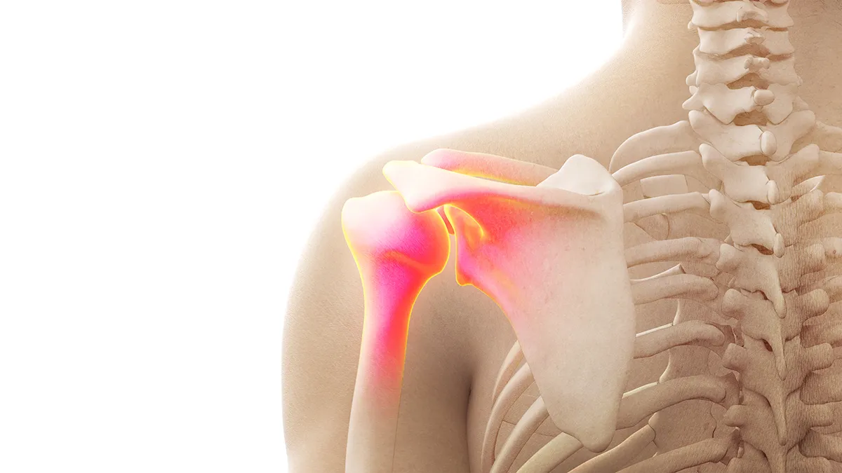 Arthrose de l'épaule - Dr Nicolas Blanchet, Chirurgie orthopédique à Argonay