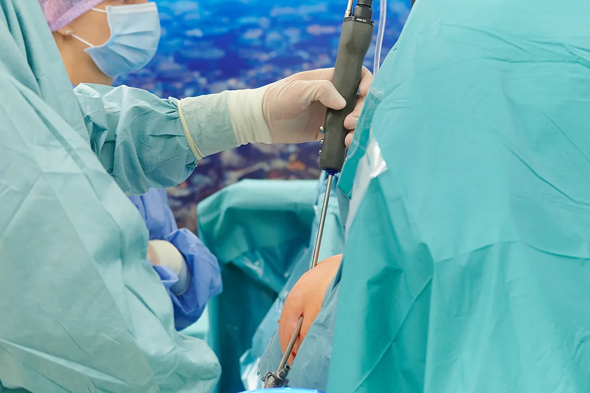 Les instabilités de l'épaule - Dr Nicolas Blanchet, Chirurgie orthopédique à Argonay